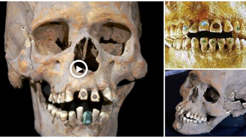 Antiquity thrived on stone attachment: A 1,600-year-old skull with stone-encrusted teeth has been found at the Mexican Ruins.