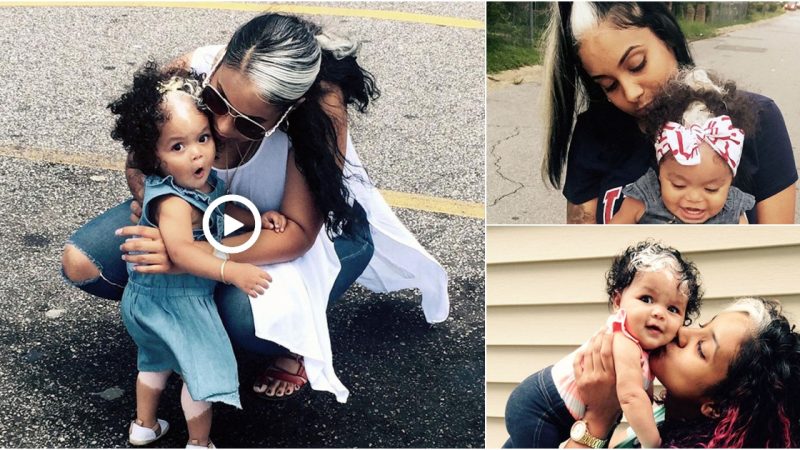 Little Girl Born With A White Patch Of Hair That Is Exactly Like Her Mother’s