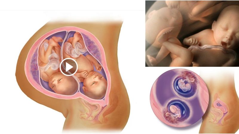 Month by month fetal development of twins in the womb.