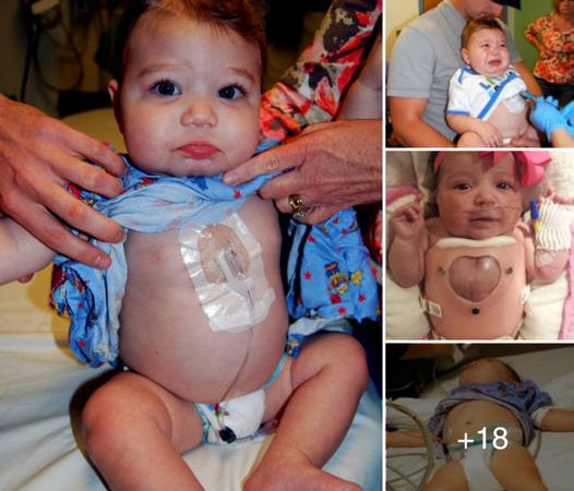 Against All Odds: The Astonishing Story of a Baby Born with His Heart Exposed