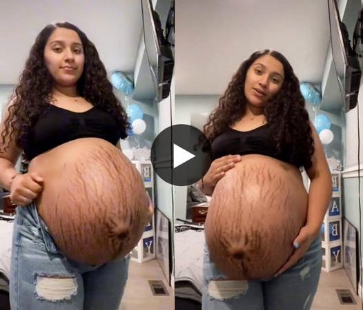 Pregnancy Surprise: What Lies Beneath This Woman’s Enormous Baby Bump?