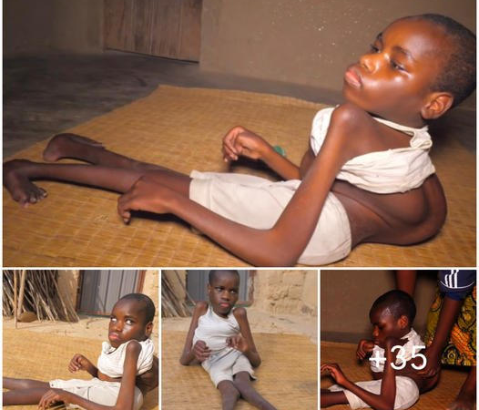 Unbelievable Transformation: Overcoming Challenges with Backward Feet