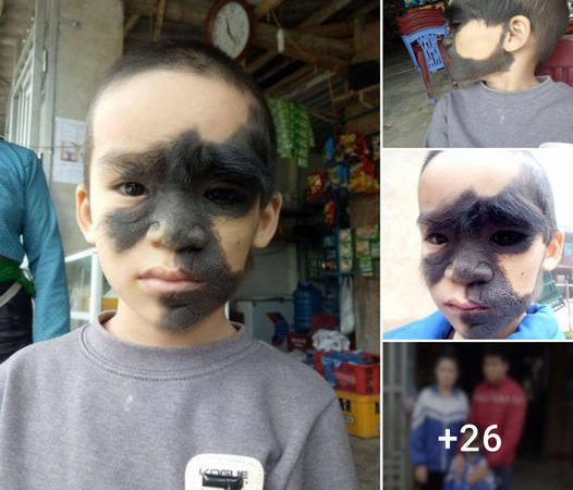 A Mother’s Dream: Transforming the Life of a Boy with a “Monkey” Face