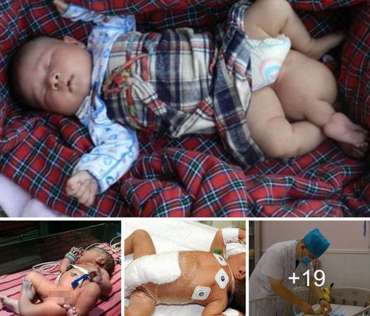 After Discovering Their Newborn Has a Third Leg, Parents Make Heartbreaking Decision to Abandon the Child