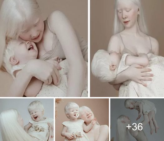 Captivating Charisma: The Enchanting Beauty of Two Albino Sisters Leaves a Lasting Impression (Video)