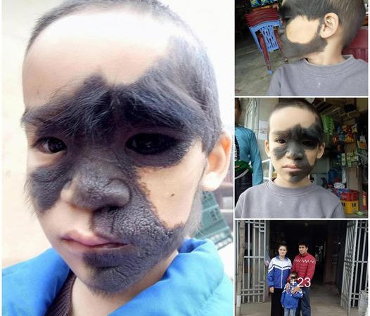 A Brave Boy’s Inspiring Journey: Overcoming Facial Challenges with Hope