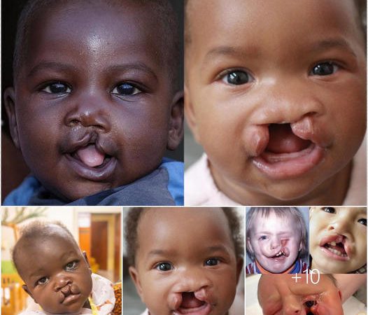 Captivating African Children’s Smiles: A Beacon of Resilience and Joy