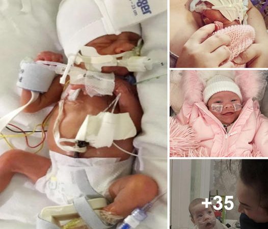 A Miracle of Resilience: Ayla-Grace’s Premature Birth Journey